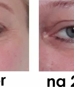 Solutions Cosmeceuticals Happy Eyes Instant Eyelift - Werkt Na 2 Minuten - Anti-aging - Anti-rimpel Oog Cr Me - Oog Contour Cream - Natuurlijke Ingredi Nten -Chanel Shop 550x291 2