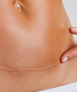 Dermarolling Titanium Dermaroller 0.5 Mm Inclusief 30ml. Dermarolling Vitamine C Serum -Chanel Shop 550x308 6