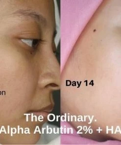 FIRST SUN ? First SUN - Alpha Arbutin 2 + Ha Serum - Hyperpigmentatie - Donkere Vlekjes - Huidproblemen - Dofheid - Hyperpigmentatie - Vlekjes - Oneffen Teint En Textuur -Chanel Shop 550x309 25