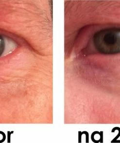 Solutions Cosmeceuticals Happy Eyes Instant Eyelift - Werkt Na 2 Minuten - Anti-aging - Anti-rimpel Oog Cr Me - Oog Contour Cream - Natuurlijke Ingredi Nten -Chanel Shop 550x323