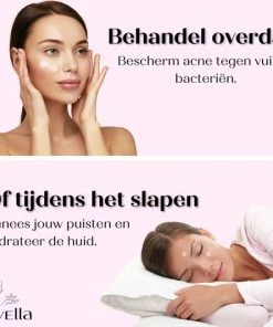 Lovella Pimple Patch 216 Stuks, Acne Patch, Acne Pleister, Pimple Patches, Puisten Verwijderaar, Puisten Pleister, Hydrocolloïd -Chanel Shop 550x533 2