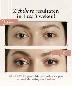 Cosas & M?s Cosas & M S - Wimperserum - Lash Lift - Wenkbrauw Serum - 3 Ml - Incl. Make-up Tasje - Incl. Cadeau Zakje - Cadeau Voor Haar 14 Cosas & M?s Cosas & M S - Wimperserum - Lash Lift - Wenkbrauw Serum - 3 Ml - Incl. Make-up Tasje - Incl. Cadeau Zakje - Cadeau Voor Haar -Chanel Shop 550x550 221