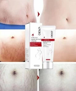 Efero Anti-Striae Serum - Zwangerschap Litteken Op Buik Verwijderen - Striae Verwijderen - Huid Reparatie - Zwangerschap Littekens Behandeling - Lichaam Huidverzorging - Litteken Verwijderen- Anti Striae Creme - Zwangerschap Striemen - Snel Afgevallen -Chanel Shop 550x550 565