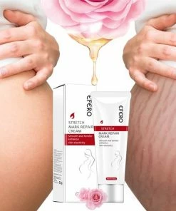 Efero Anti-Striae Serum - Zwangerschap Litteken Op Buik Verwijderen - Striae Verwijderen - Huid Reparatie - Zwangerschap Littekens Behandeling - Lichaam Huidverzorging - Litteken Verwijderen- Anti Striae Creme - Zwangerschap Striemen - Snel Afgevallen -Chanel Shop 550x550 567