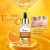 IBHW Lifestyle Vitamine C Gezicht Serum | Hyaluronzuur |Pigmentvlekken | Acne | Puisten | Huid | Egaal | Stralend | Vitamine C |Vitamine E|Man| Pigment| Huidverjongend | Huidverjonging | Collageen | ISO Certificaat | UV Schade | Rosacea 2 IBHW Lifestyle Vitamine C Gezicht Serum | Hyaluronzuur |Pigmentvlekken | Acne | Puisten | Huid | Egaal | Stralend | Vitamine C |Vitamine E|Man| Pigment| Huidverjongend | Huidverjonging | Collageen | ISO Certificaat | UV Schade | Rosacea -Chanel Shop 550x655