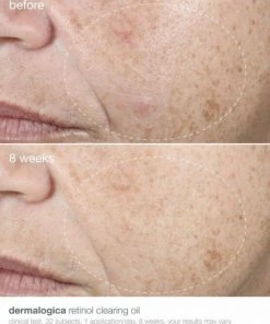 Dermalogica Retinol Clearing Oil Gezichtsolie 30ml -Chanel Shop 550x687 12